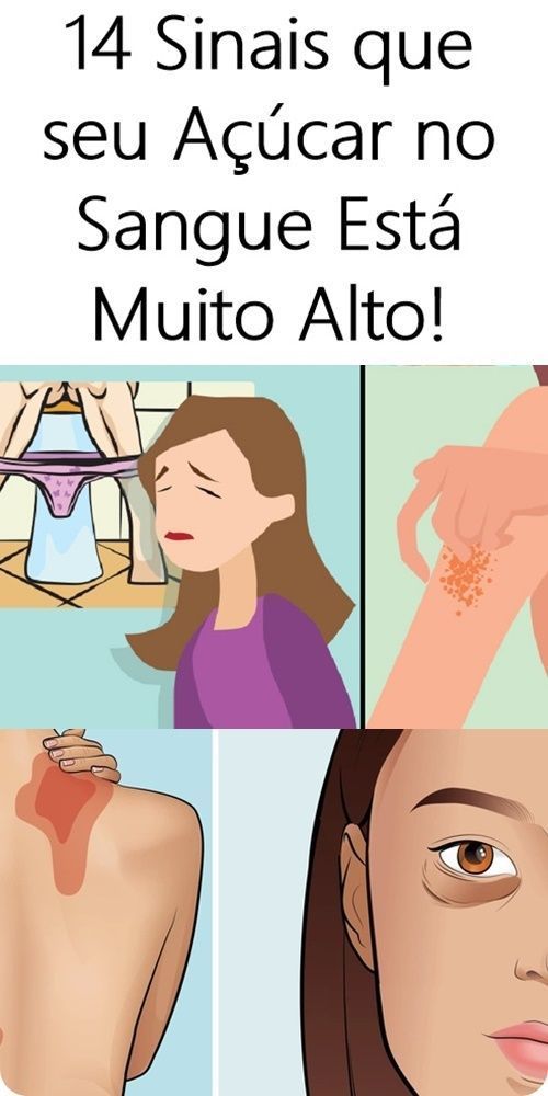 14 Sinais que Açúcar Esta Muito Alto no Sangue!