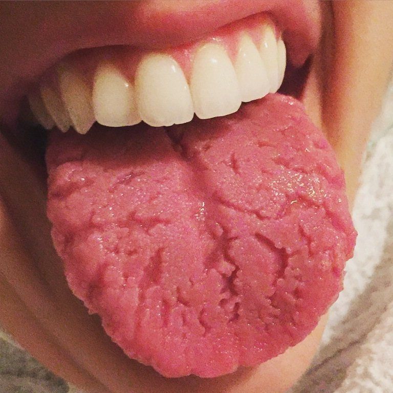 Isto é o que sua língua tem a dizer sobre sua saúde! - O Segredo