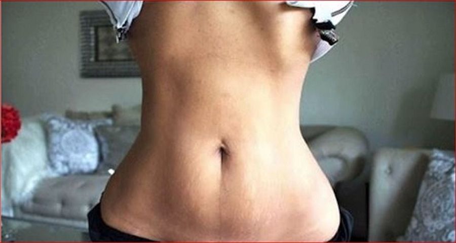 Como perder vários centímetros de cintura sem fazer dieta - funciona logo nas primeiras vezes