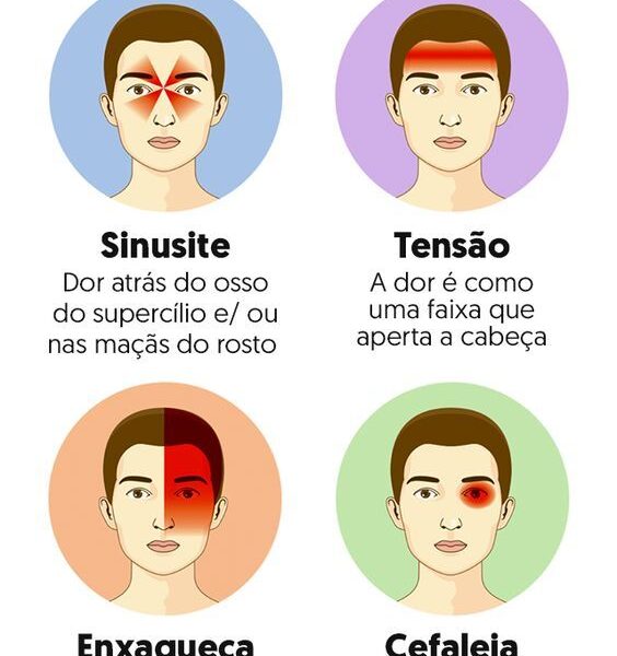 Principais tipos de dor de cabeça: sintomas, causas e tratamento