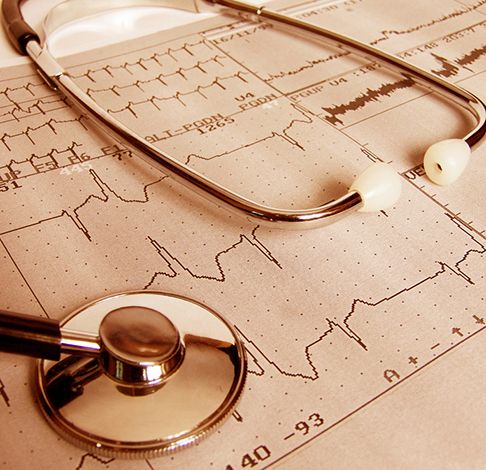 What Do Heart Palpitations Mean?
