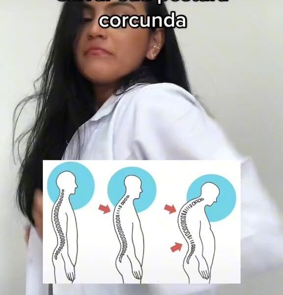 Exercício para melhorar sua postura.
