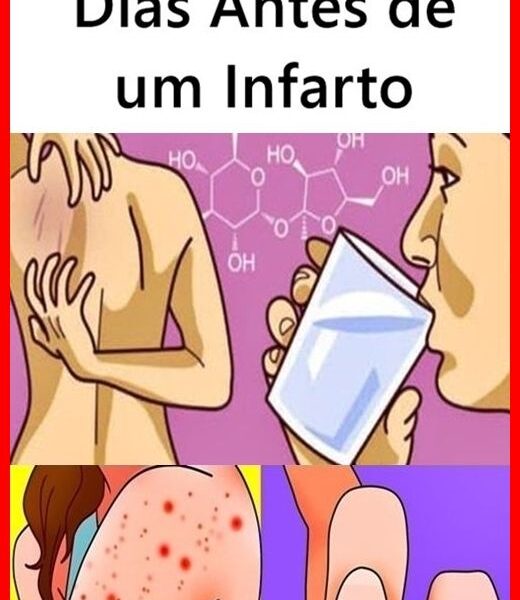 Sintomas que o Corpo Dá Dias Antes de um Infarto