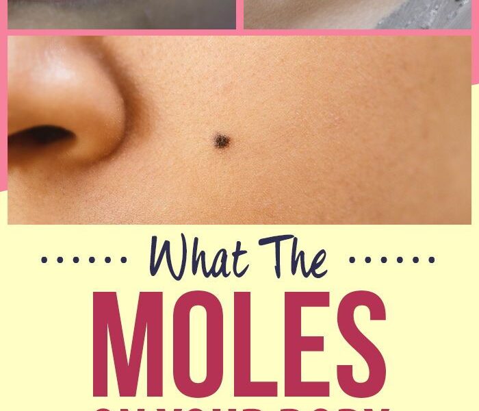 Here is What The Moles On Your Body Say About Your Personality