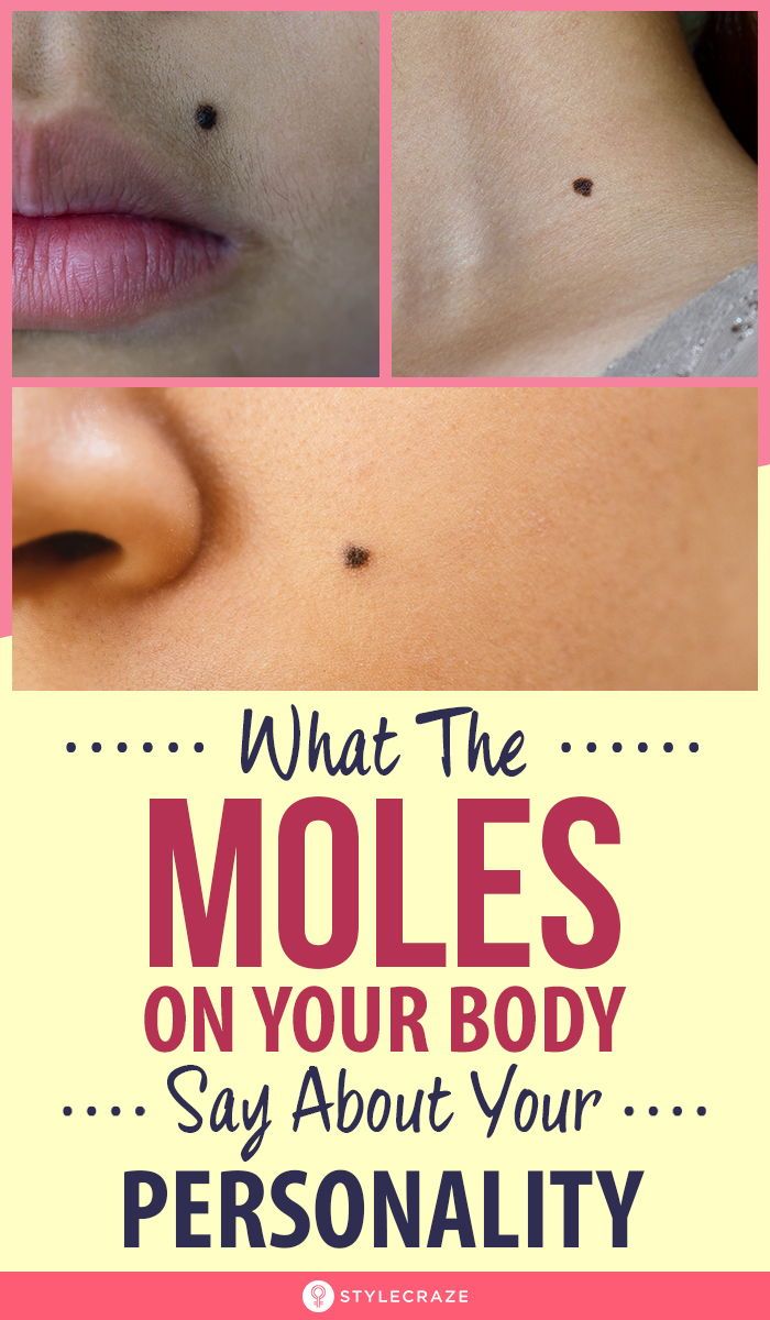 Here is What The Moles On Your Body Say About Your Personality